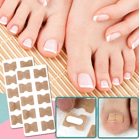 Luvikno | ProFlexiPatches — Painless naturlige negler som du igjen viser stolt