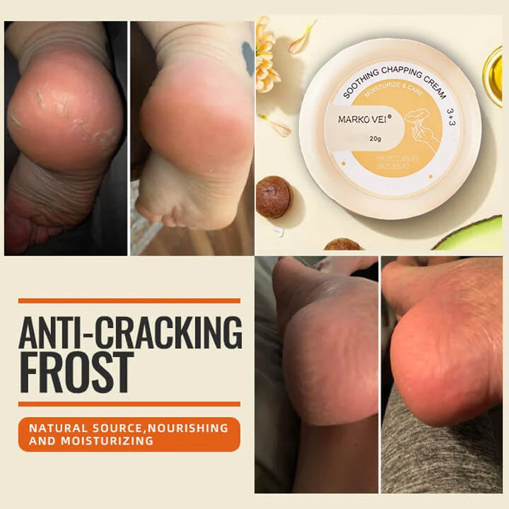 Winter Anti-Rip Frost | Luvikno