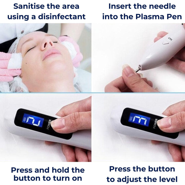 DermaGlow | Mole Removal Pen – Ikke-invasiv plasma – Trådløs & oppladbar – Hjemmebehandling for hudflikker & fregner Luvikno