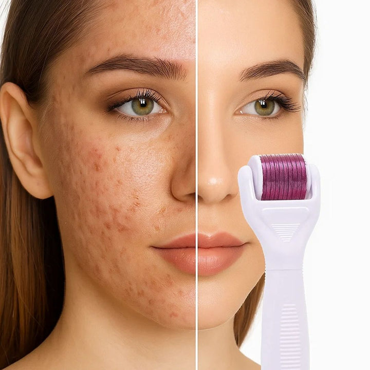 DermaGlow Microneedling Derma Roller Kit – Anti-Aging – Titannåler – Hjemmeskincare for Kvinner Luvikno