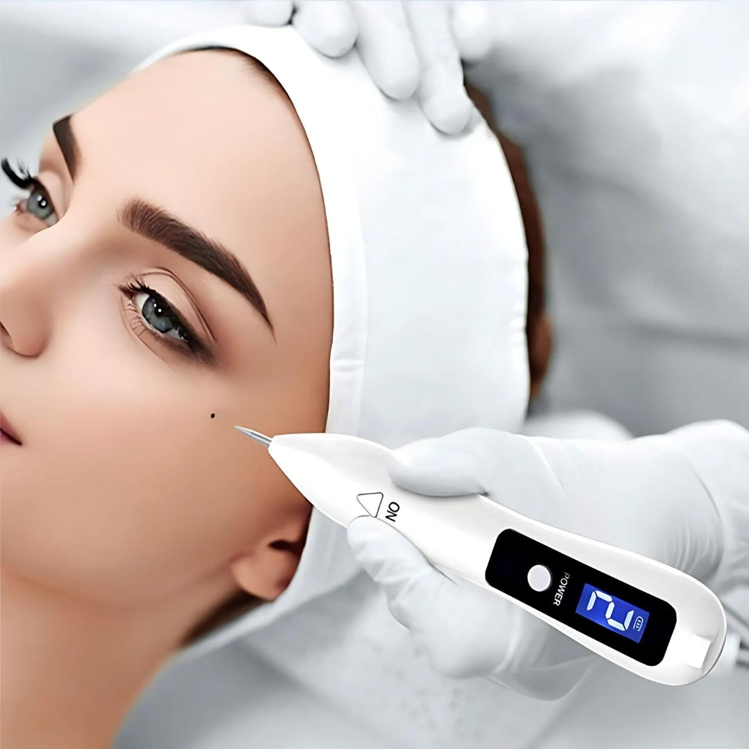 DermaGlow | Mole Removal Pen – Ikke-invasiv plasma – Trådløs & oppladbar – Hjemmebehandling for hudflikker & fregner Luvikno