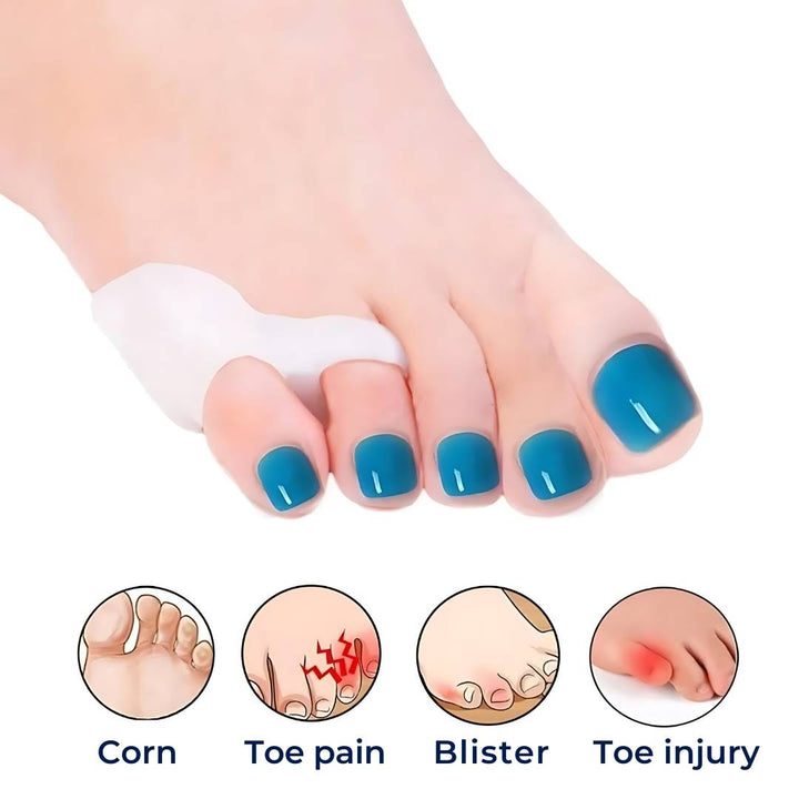 ToeGuard ortopediske tåspacer | Bunionette korrigerer - Lite tå rettet - for hallux valgus - Hammertoe og tåjustering Luvikno