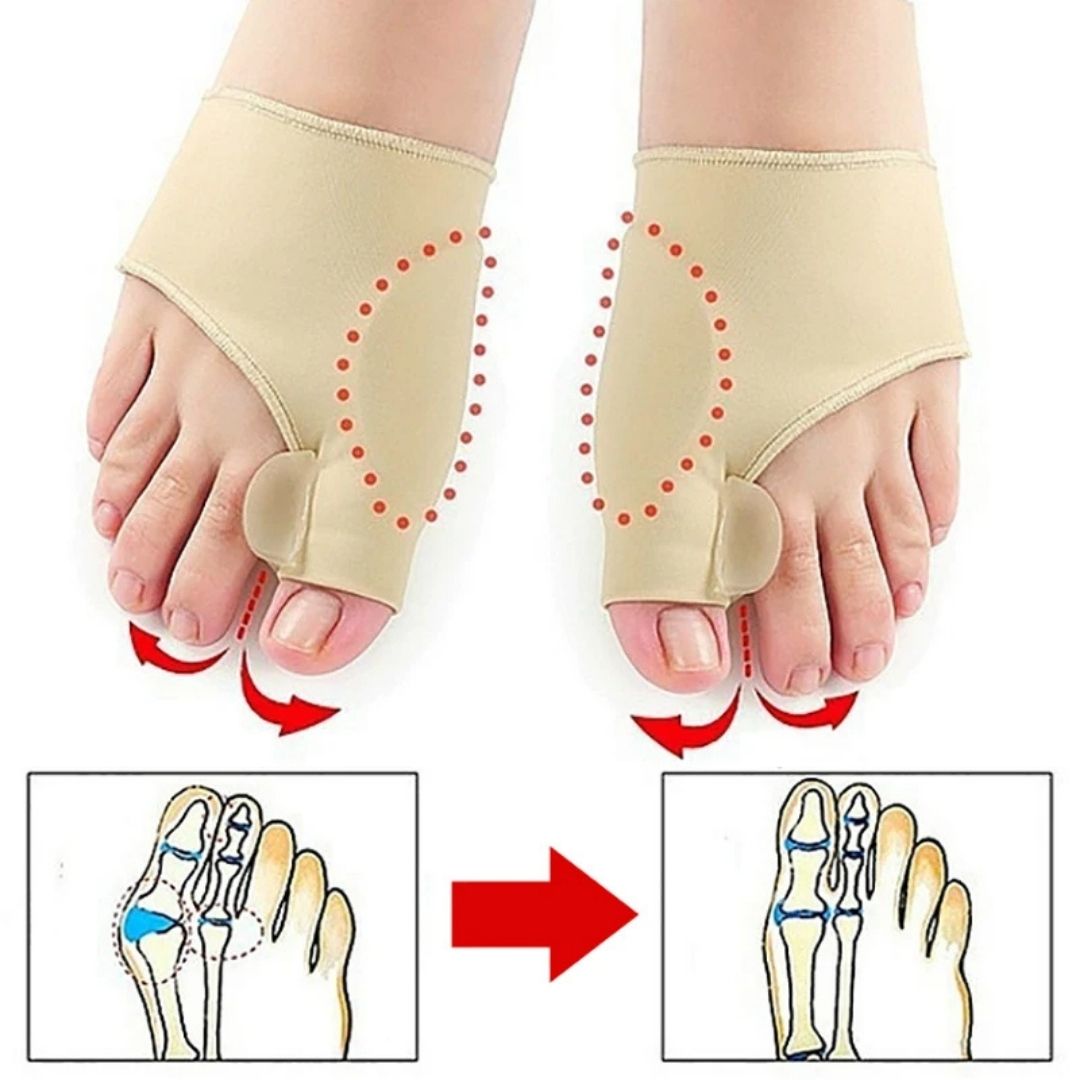 AlignWell Hallux Valgus Korrigerings Tå Separator | for Storetå Rejustering og Smertelindring – Ikke-Invasiv Løsning for Hallux Valgus Luvikno