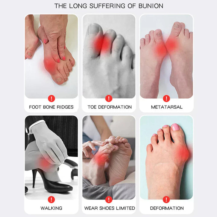 Luvikno | OrthoFlex – Komfortabel gåing med Hallux Valgus lindring!