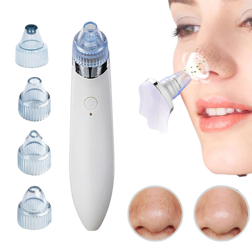 Luvikno | LuxeGlow Elite Blackhead Remover | Oppladbar 4-i-1 løsning for klar, strålende hud