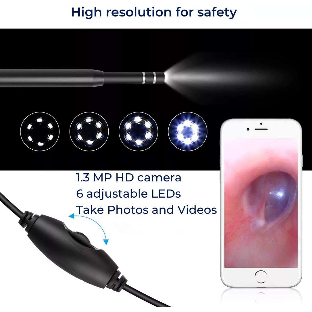 EarVision Profesjonell Øre Endoskop – HD Inspeksjon – Live Overvåking – Fang Bilder & Video – Fjerner Voks & Fremmedlegemer Luvikno