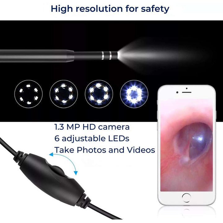 EarVision Profesjonell Øre Endoskop – HD Inspeksjon – Live Overvåking – Fang Bilder & Video – Fjerner Voks & Fremmedlegemer Luvikno