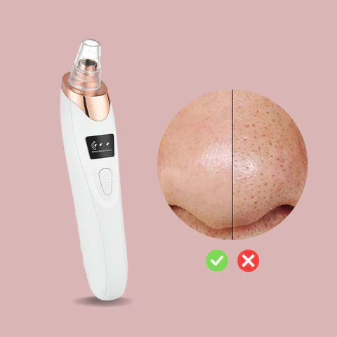 Luvikno | Nano Elektrisk Vakuum Blackhead Fjerningsverktøy — Frigjør din strålende, klare hud uten smerte eller stress