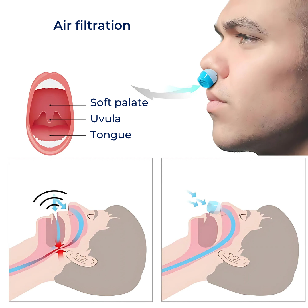 SilentEase | Anti-Snorke Nese Dilatatorer – Snorke Lindring – Myk Silikon – Komfortabel Passform for Voksne Luvikno