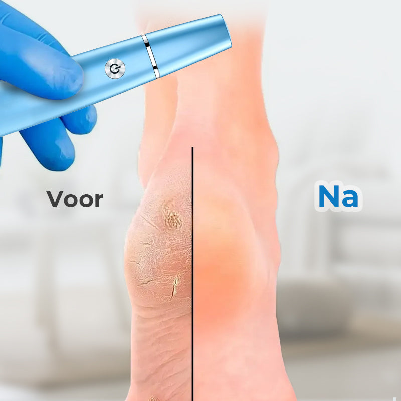SmoothFoot – Oppnå silkeslitt føtter på bare noen få minutter Luvikno