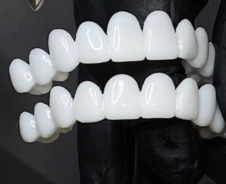 Smile Lens – Justerbar hvit tannprotese for umiddelbar smilkorreksjon | Luvikno