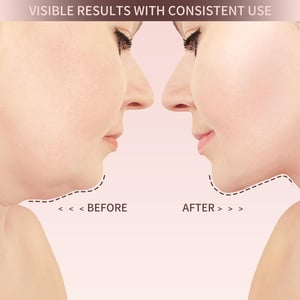 Luvikno | VitaLift – Naturlig vakker i alle aldre