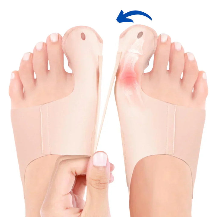 Luvikno | OrthoFlex – Komfortabel gåing med Hallux Valgus lindring!