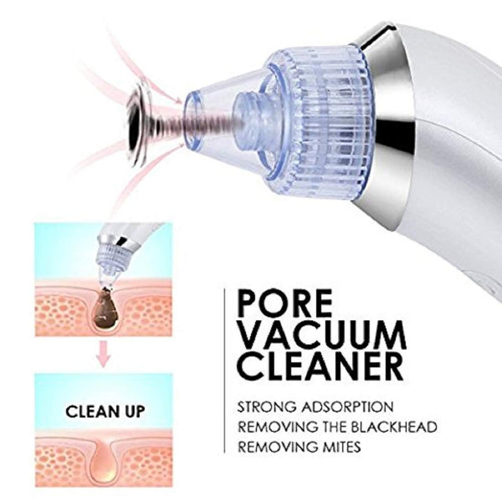 Luvikno | LuxeGlow Elite Blackhead Remover | Oppladbar 4-i-1 løsning for klar, strålende hud
