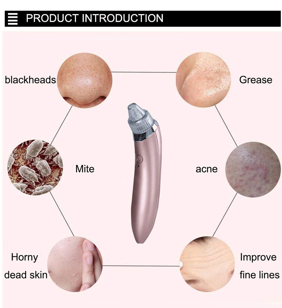 Luvikno | LuxeGlow Elite Blackhead Remover | Oppladbar 4-i-1 løsning for klar, strålende hud