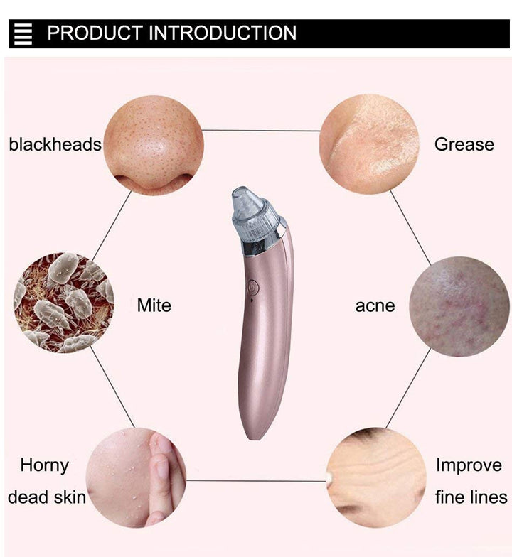 Luvikno | LuxeGlow Elite Blackhead Remover | Oppladbar 4-i-1 løsning for klar, strålende hud