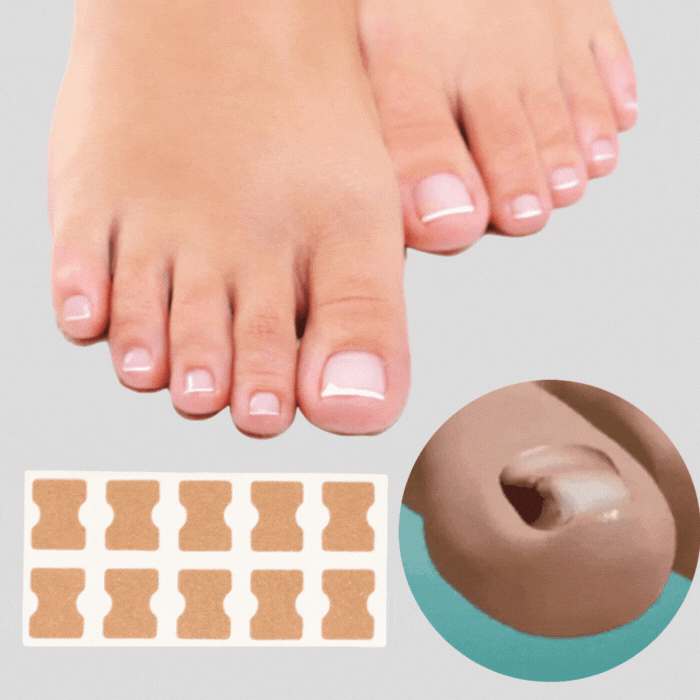 Luvikno | ProFlexiPatches — Painless naturlige negler som du igjen viser stolt