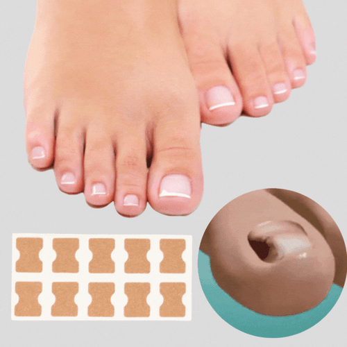 Luvikno | ProFlexiPatches — Painless naturlige negler som du igjen viser stolt