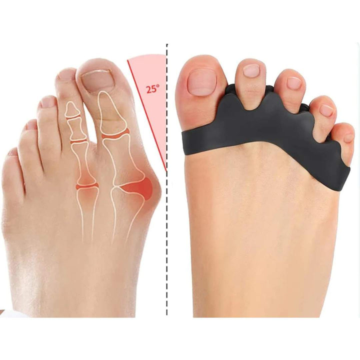 FlexAlign Tå Separator | Tå Justering og Smertelindring – Ideell for Hallux Valgus - Overlappende Tær - og Fot Komfort Luvikno