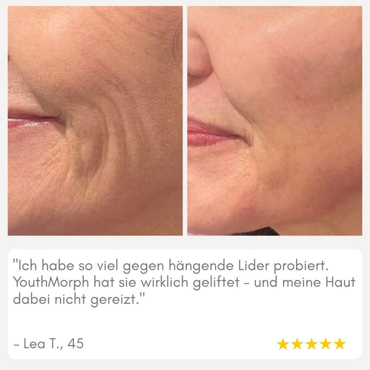 Luvikno | YouthMorph — Tett hud på minutter for ditt ungdommelige WOW-øyeblikk