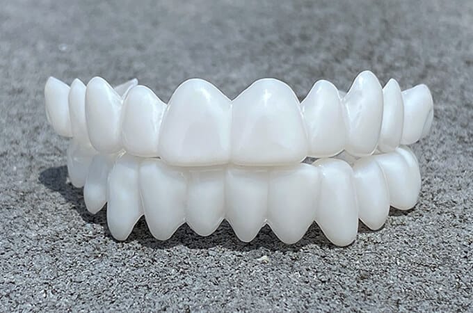 Kosmetiske Tann Toppers SmileShape – Gjenbrukbar, Fleksibel og Naturlig Hvit | Luvikno