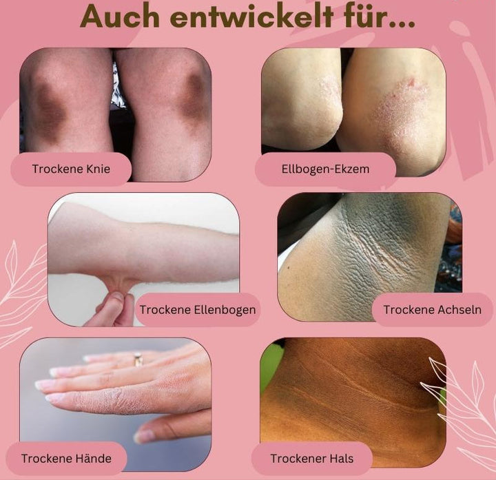 Luvikno | Dermashield — Rask lindring for sprukne, kløende føtter som ønsker å puste fritt