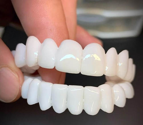 Cosmetic Tooth Tips SmileVorm – Gjenbrukbare, Fleksie og Naturlig Hvite | Luvikno