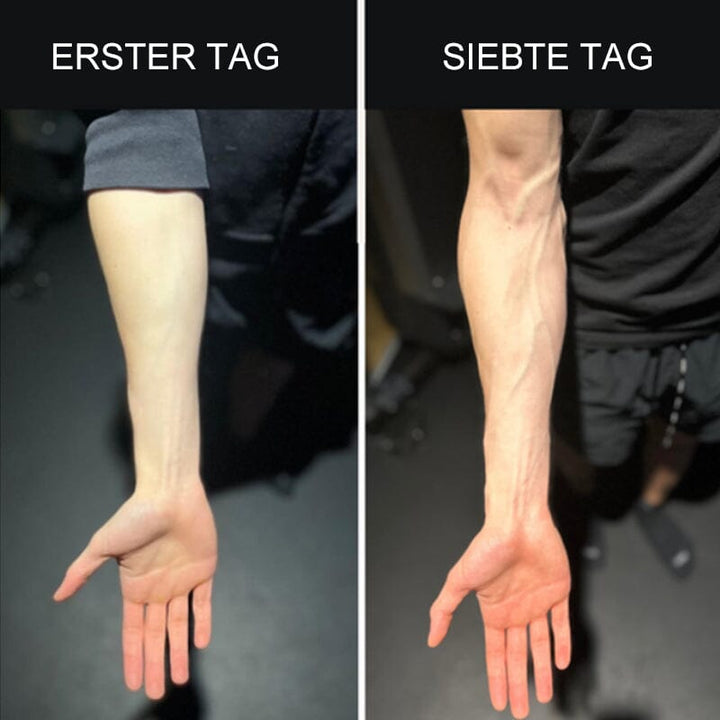 Luvikno | Silikon Finger Treningstrener