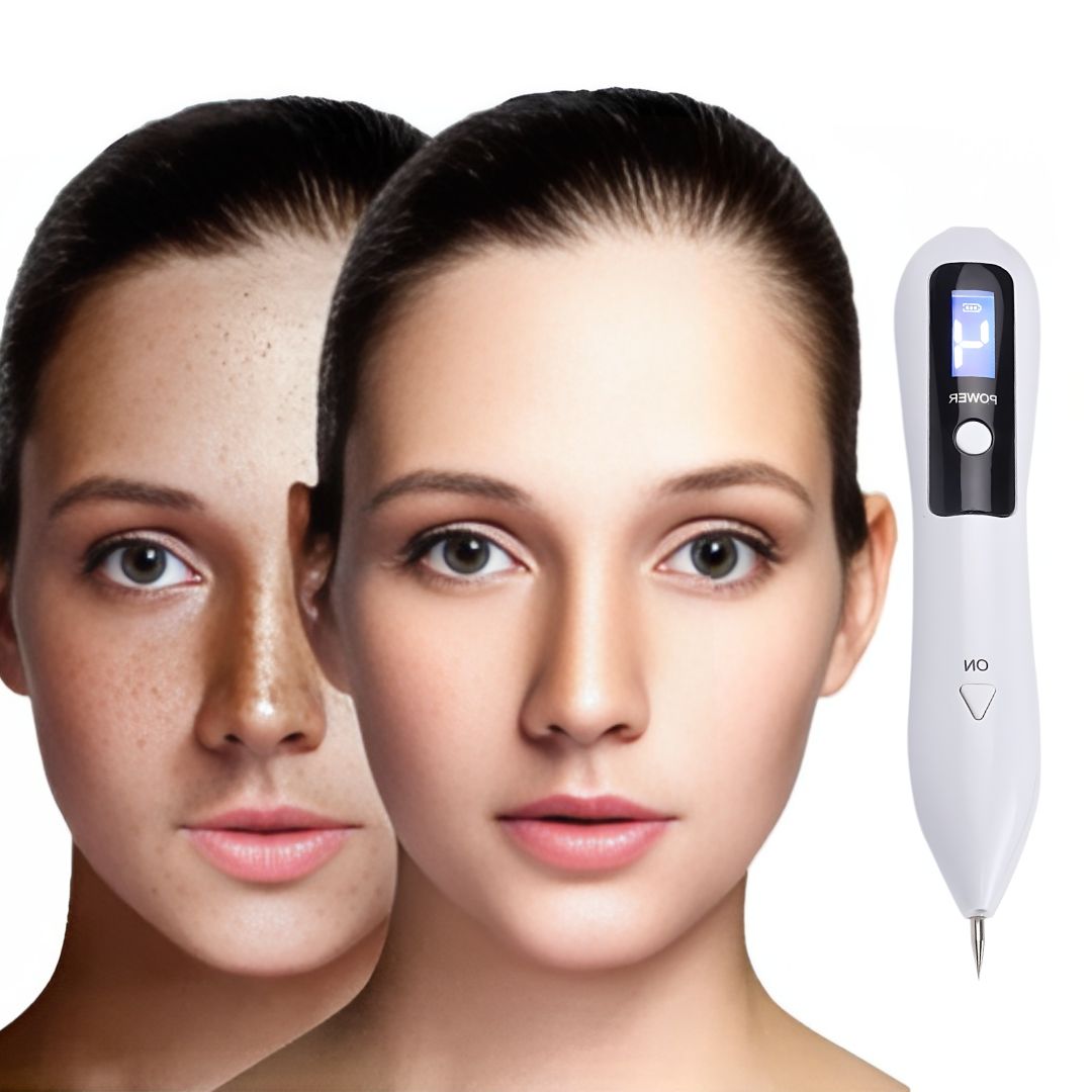 DermaGlow | Mole Removal Pen – Ikke-invasiv plasma – Trådløs & oppladbar – Hjemmebehandling for hudflikker & fregner Luvikno