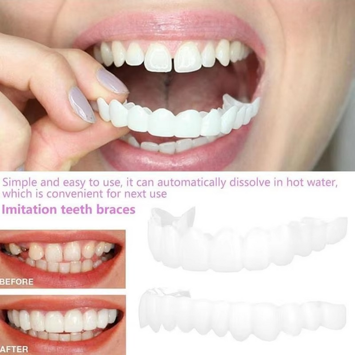 2PCS Snap-On Veneer Proteser for Menn og Kvinner, Umiddelbar Midlertidig Tannbeskyttelse for et Selvsikkert Smil Luvikno