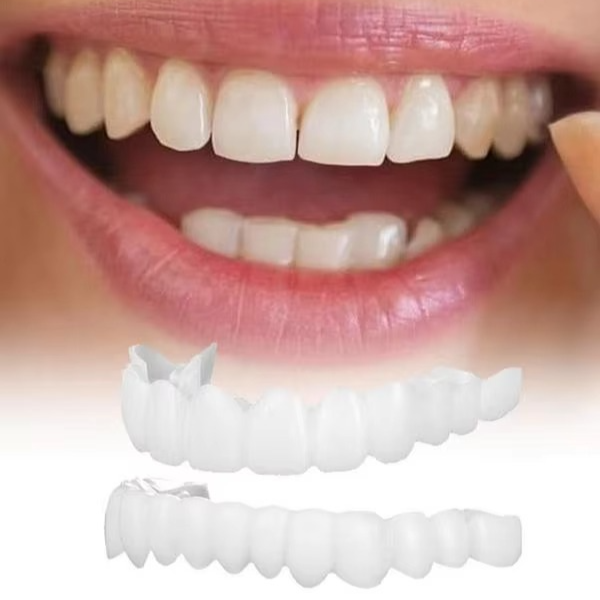 2PCS Snap-On Veneer Proteser for Menn og Kvinner, Umiddelbar Midlertidig Tannbeskyttelse for et Selvsikkert Smil Luvikno