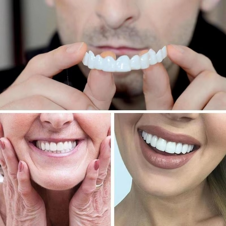 2PCS Snap-On Veneer Proteser for Menn og Kvinner, Umiddelbar Midlertidig Tannbeskyttelse for et Selvsikkert Smil Luvikno
