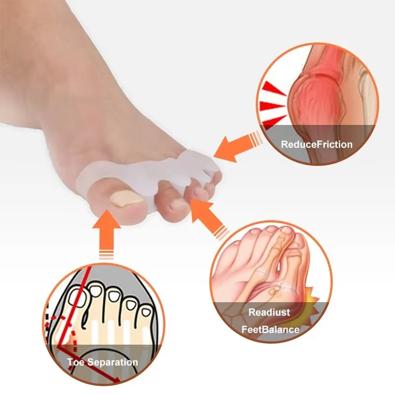 Myke silikon tåseparatorer for hallux valgus lindring og justering, 1 par Luvikno