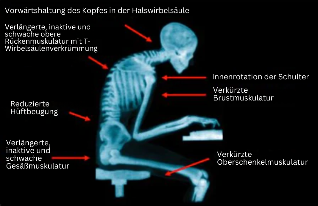 Luvikno | EMS-Holdt Bandasje - PosturePro
