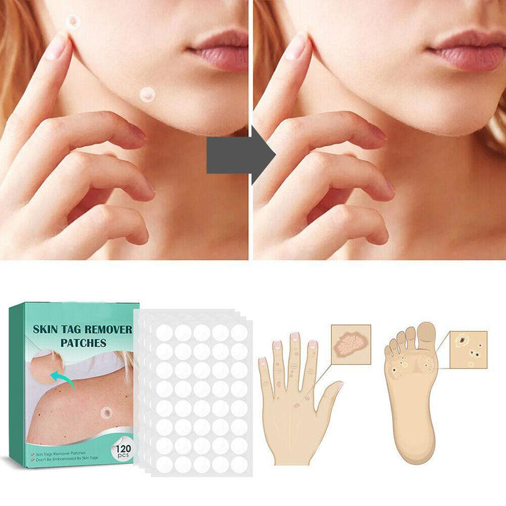 SkinClear - Patches for fjerning av flekker og vorter Luvikno
