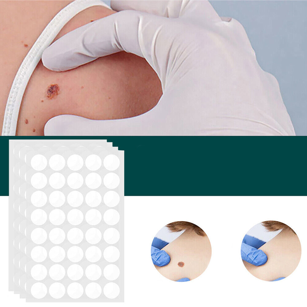 SkinClear - Patches for fjerning av flekker og vorter Luvikno