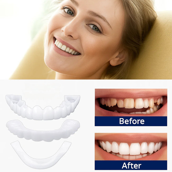 SmileEase | Clip-On Veneers – Umiddelbar Smilforbedring – Ultratynn Design – Ideell for voksne som søker rimelige tannhelse-løsninger Luvikno