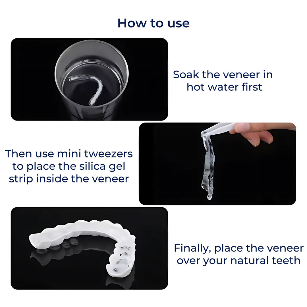 SmileEase | Clip-On Veneers – Umiddelbar Smilforbedring – Ultratynn Design – Ideell for voksne som søker rimelige tannhelse-løsninger Luvikno