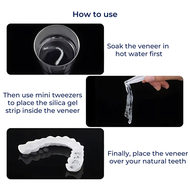 SmileEase | Clip-On Veneers – Umiddelbar Smilforbedring – Ultratynn Design – Ideell for voksne som søker rimelige tannhelse-løsninger Luvikno