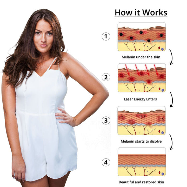 Tattoo Removal Laser Luvikno