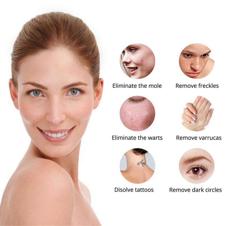 Tattoo Removal Laser Luvikno