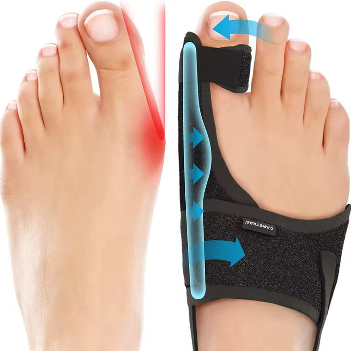 Luvikno | Natt Støtte Hallux Valgus - Ergonomisk og Justerbar Komfort