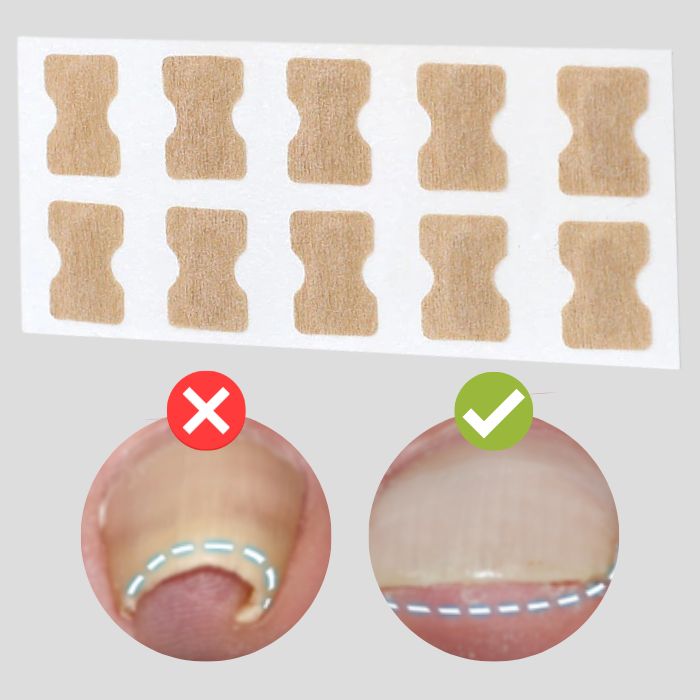 Luvikno | ProFlexiPatches — Painless naturlige negler som du igjen viser stolt