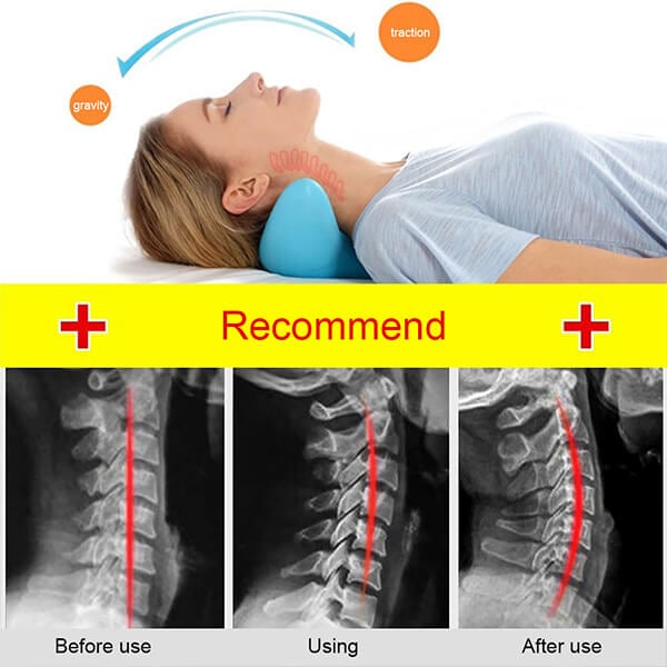 NeckEase Stretch – Ergonomisk Nakkepute for Nakkavslapning | Luvikno