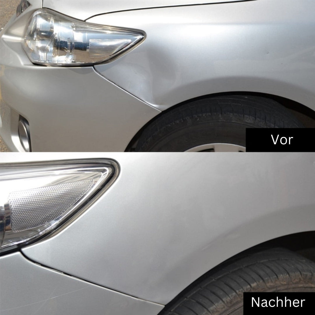 DeukFix Reparasjonssett – Bilbulker Fjerning Uten Lakk Damage | Luvikno