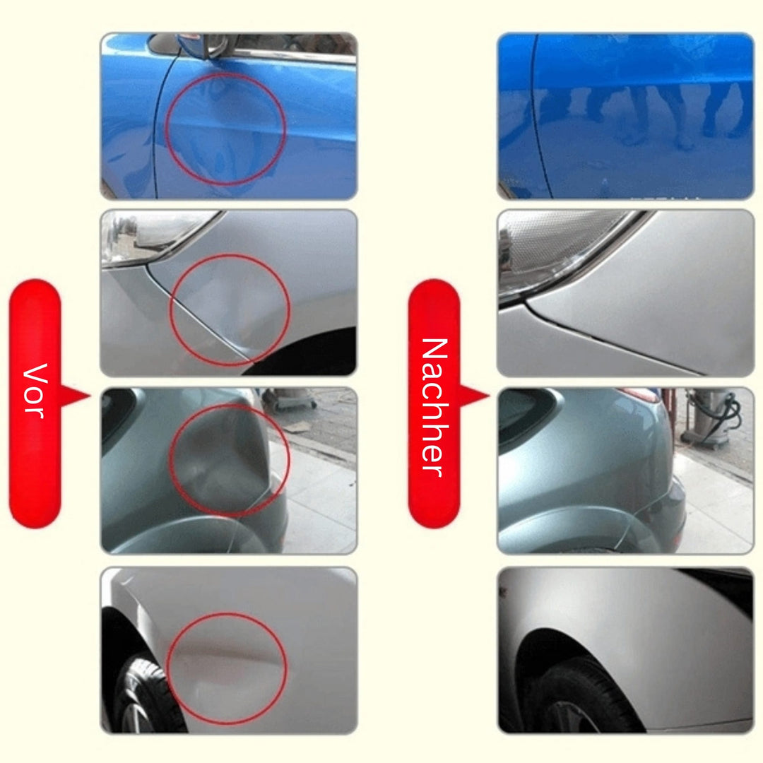 DeukFix Reparasjonssett – Bilbulker Fjerning Uten Lakk Damage | Luvikno