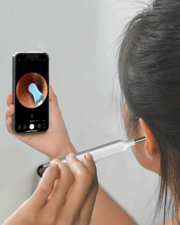 Intelligent Øre Cleaner | Trygg, Skånsom, Effektiv | Luvikno