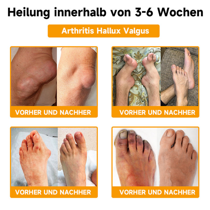 Bienen-Vital-Creme | Rask smertelindring | Luvikno