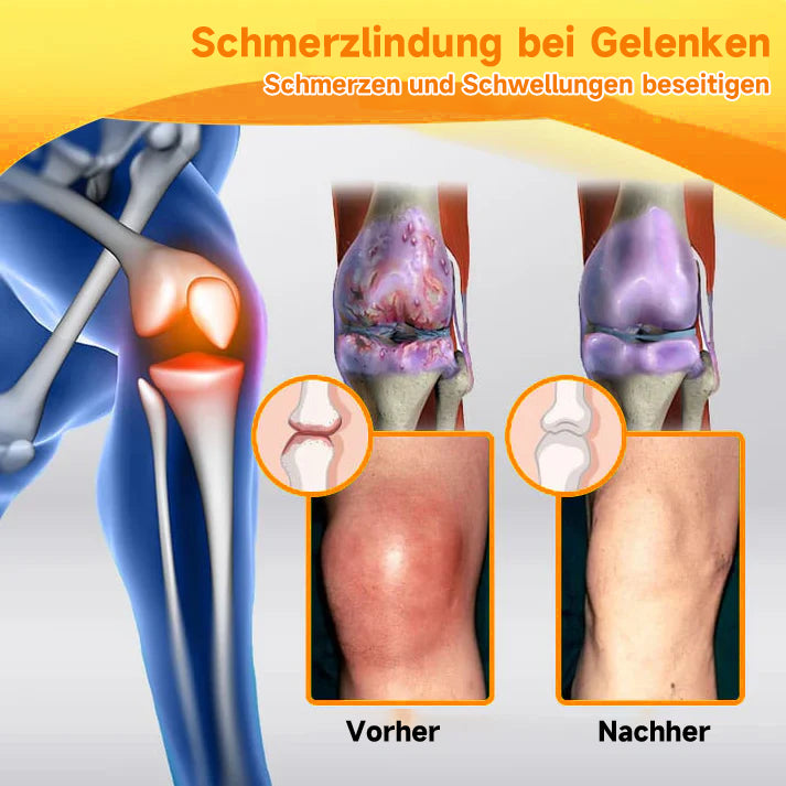 Bienen-Vital-Creme | Rask smertelindring | Luvikno