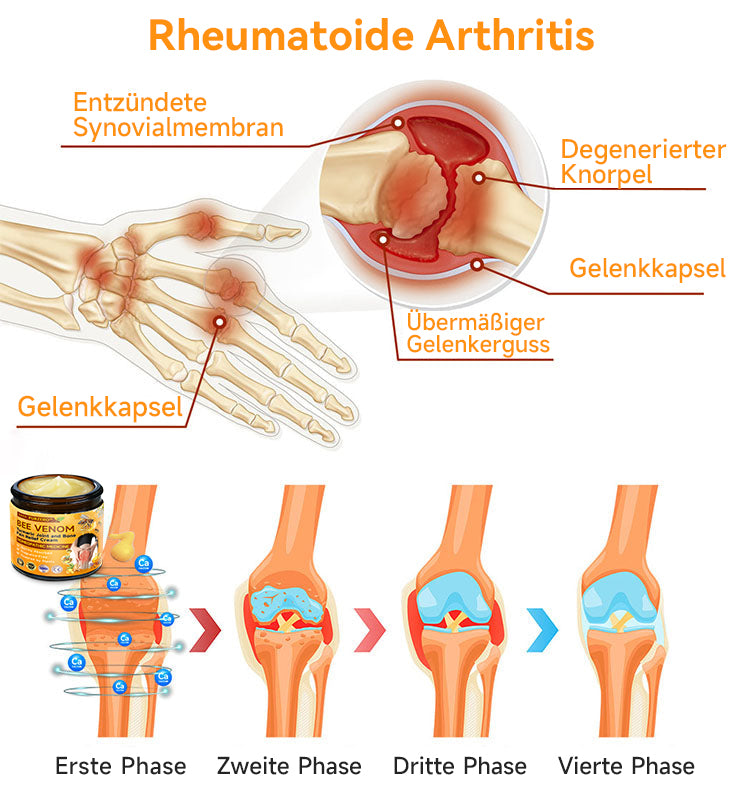 Bienen-Vital-Creme | Rask smertelindring | Luvikno